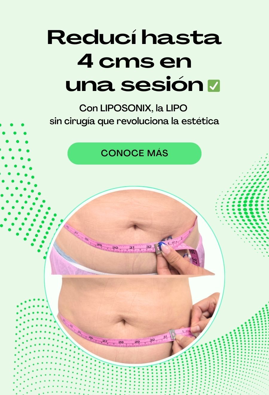Rejuvence sin cirugias