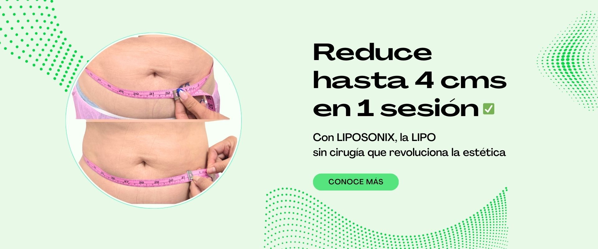 Rejuvence sin cirugias